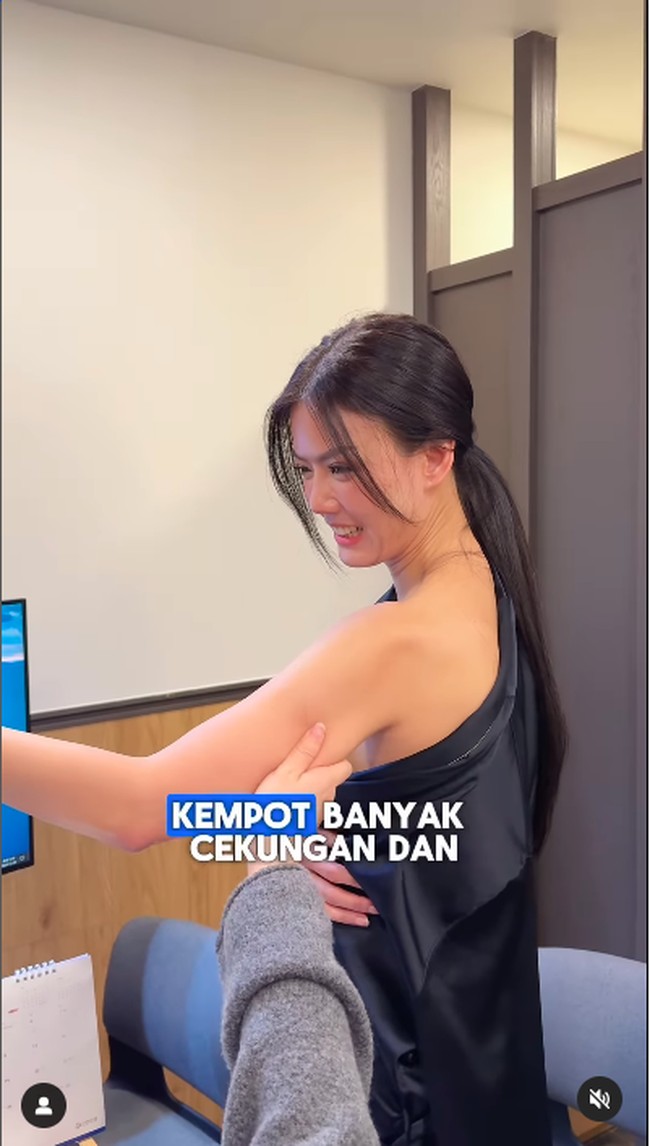 Dalam postingannya, Nita menjelaskan bahwa fat graft adalah tindakan memasukan lemak yang ada di tubuh ke dalam wajah yang fungsinya hampir sama dengan filler. Menurutnya, perawatan itu lebih sehat karena fat graft bisa hilang seiring waktu tidak seperti filler yang mengendap. Foto: Instagram Nita Gunawan