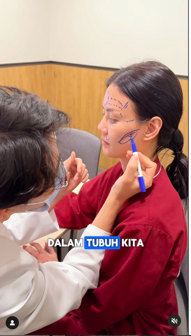 Wanita yang juga presenter dan MC itu pun mengungkap jika perawatan itu dilakukan bukan untuk mengubah wajah tapi memperbaikinya. Foto: Instagram Nita Gunawan