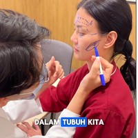 Wanita yang juga presenter dan MC itu pun mengungkap jika perawatan itu dilakukan bukan untuk mengubah wajah tapi memperbaikinya. Foto: Instagram Nita Gunawan