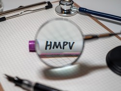 Virus HPMV Masih Misterius dan Belum Banyak Dikenal, Tapi...