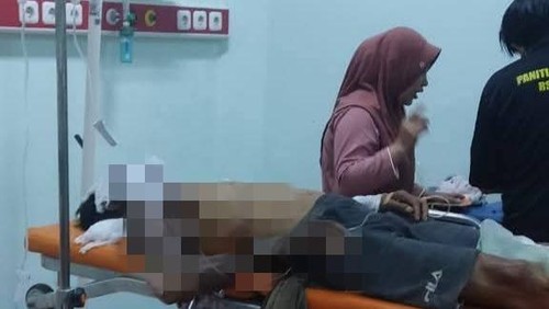 Kondisi korban terbakar karena kebocoran tabung gas di Dusun Beber Lauq, Desa Pengenjek, Lombok Tengah, Sabtu (4/1/2025) malam. (istimewa)