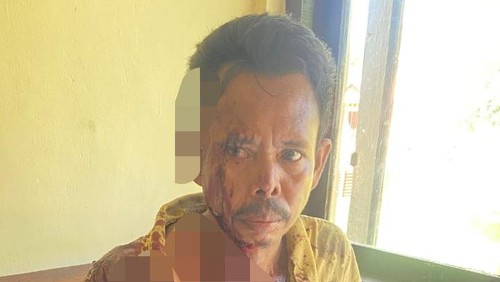 Yafet Lalay, korban pembacokan dari adik sepupunya, Ferdinan Lalay saat membuat laporan polisi di Polsek Rote Timur.