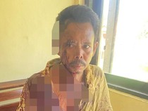 Pria di Rote Ndao Dibacok Sepupu karena Sengketa Sawah