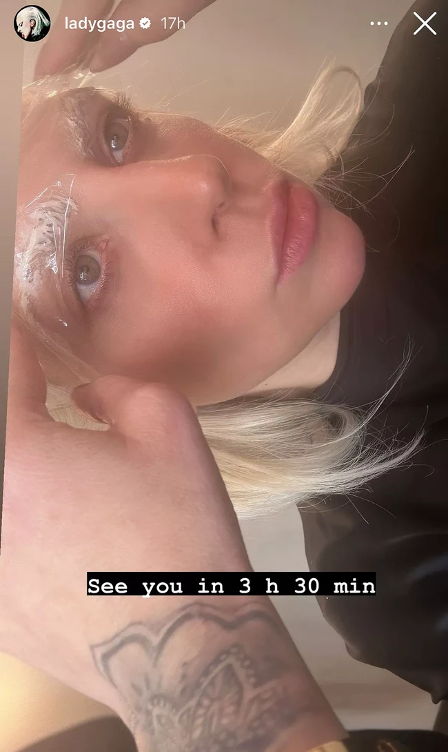 Dalam unggahannya di Instagram Story pada Mei 2024 lalu, Lady Gaga memperlihatkan foto saat alisnya dalam proses bleaching. “See you in 3 h 3 min,” begitu tulisnya di fotonya yang merujuk pada bleaching alisnya selama lebih dari 3 jam untuk mendapatkan hasil alis putih yang maksimal.  Foto: dok. Instagram @ladygaga