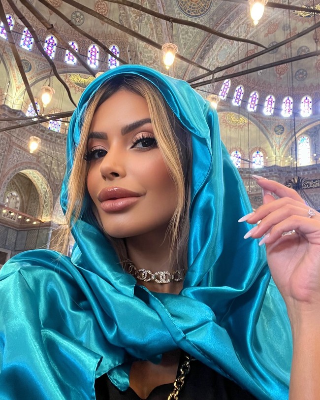 “Bee venom tidak didukung oleh para profesional medis dan tidak memiliki cukup bukti untuk membuktikan efektivitas atau keamanannya dalam jangka panjang,” kata Tunc. “Klaim bahwa pengobatan alami lebih baik daripada prosedur yang sudah ada dapat menyesatkan, karena ‘alami’ tidak selalu berarti aman. Faktanya, racun lebah adalah racun yang, jika disalahgunakan, dapat membahayakan alih-alih menyembuhkan,” lanjutnya.Foto: Instagram Janaina Prazeres