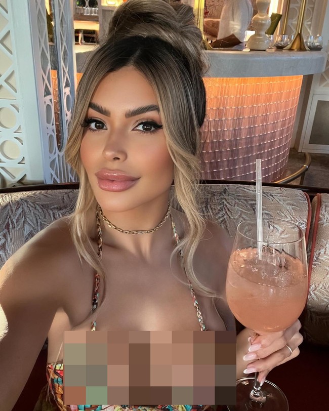 Janaina mempercayakan kecantikannya pada perawatan tersebut daripada Botox.  Bee venom sendiri memang terbukti punya fungsi anti inflamasi untuk menstimulasi sirkulasi darah dan meregenerasi sel darah. Tidak dijelaskan detailnya, tampaknya cairan dari lebah itu dimasukan dalam suntik, krim, atau serum.Foto: Instagram Janaina Prazeres