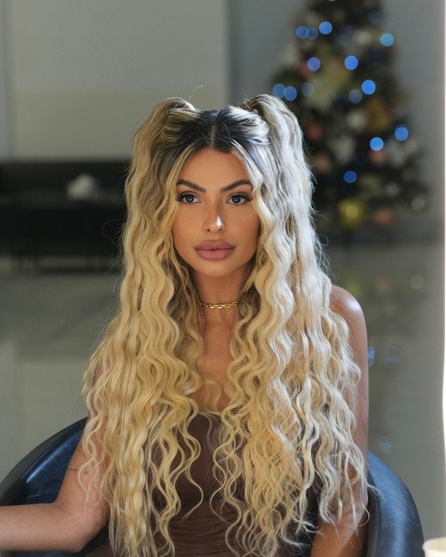 “Aku hanya menggunakan racunnya dan belum mengalami reaksi yang merugikan. Saat ini, aku mencari perawatan yang membuat penampilanku sealami mungkin. Aku tidak berpiki wanita yang terlalu plastik itu trendi atau menarik,” ujarnya dilansir Mirror.Foto: Instagram Janaina Prazeres