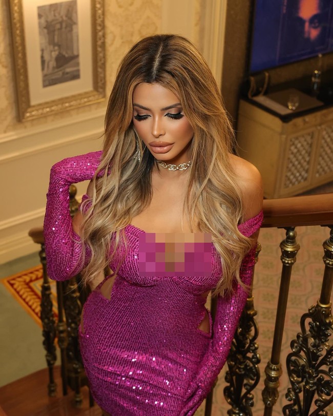 Dilaporkan Janaina telah menghabiskan £ 758.000 (Rp  15 miliaran) untuk perawatan bedah dan non-bedah, termasuk menghabiskan £ 10.000 (Rp 199 jutaan) untuk menyuntikkan sperma salmon ke bokongnya.Foto: Instagram Janaina Prazeres