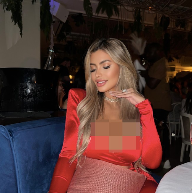 Meski mengaku aman saja tapi dokter tidak merekomendasikan perawatan bee venom untuk wajah. Konsultan dermatologis Tunc Tiryaki dari Klinik Cadogan mengatakan racun itu belum tentu baik bagi tubuh dan bisa memicu alergi.Foto: Instagram Janaina Prazeres