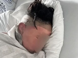 Prank Bawa Petaka, Wajah Temannya Luka Bakar Tingkat Dua