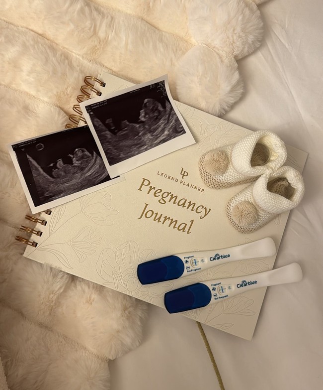 Diketahui berpacaran sejak tahun lalu, baru-baru ini terungkap bahwa Lilly-Ella dan Lee tengah menantikan anak bersama. Hal ini disampaikan Lilly sendiri di Instagram-nya. Sambil mengunggah foto scan kehamilan, wanita 20 tahun itu menulis, Our little secret. The best news... mini us is on the way,” Foto: Instagram