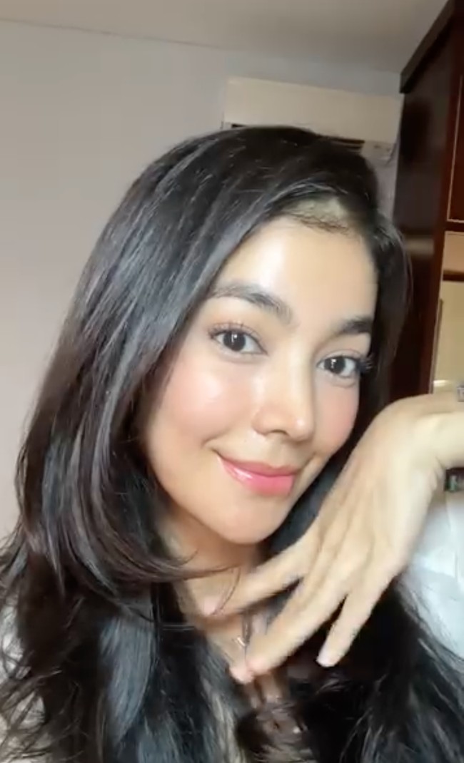 Untuk memperoleh hasil akhir 100% dari oplas yang dijalaninya, Raya masih harus menunggu sekitar 6 bulan lagi. Meski demikian dirinya sudah mengaku sangat senang dan puas karena wajahnya kini terlihat lebih segar dan rapih. Foto: Instagram/@rayakohandi244