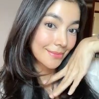 Untuk memperoleh hasil akhir 100% dari oplas yang dijalaninya, Raya masih harus menunggu sekitar 6 bulan lagi. Meski demikian dirinya sudah mengaku sangat senang dan puas karena wajahnya kini terlihat lebih segar dan rapih. Foto: Instagram/@rayakohandi244