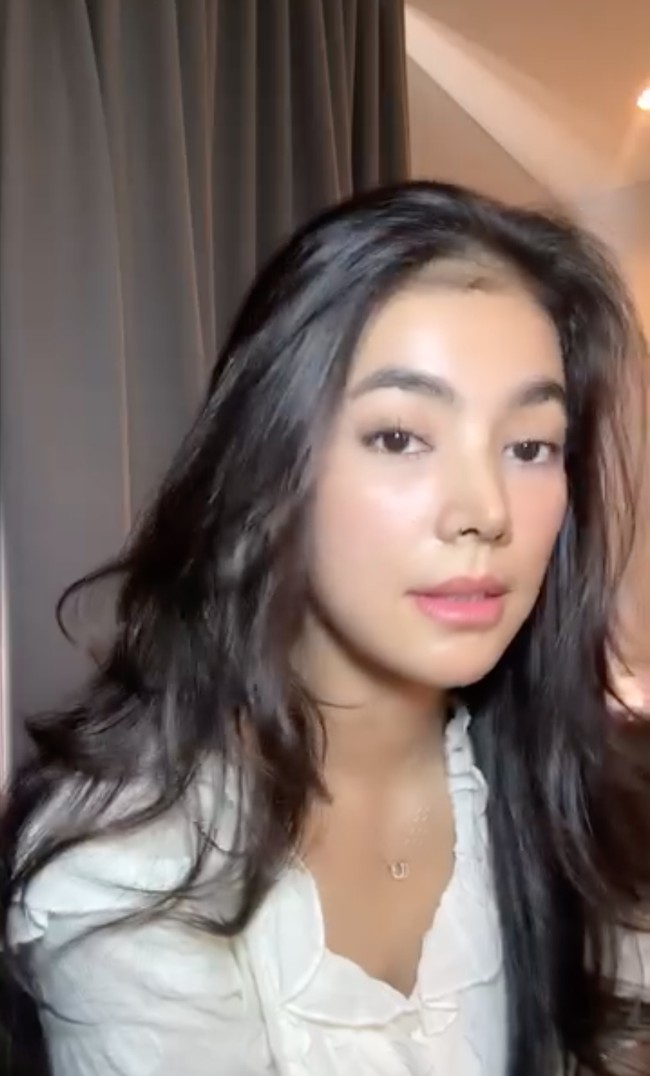 Dari unggahannya juga diketahui bahwa Raya menjalani beberapa prosedur operasi plastik, seperti rhinoplasty, endotine forehead, face contouring, dan buccal fat remover. Prosedur operasi plastiknya itu ditangani oleh 2 dokter, Dr. Oh Canghyun dan Dr. Yoo Kihyun. Foto: Instagram/@rayakohandi244