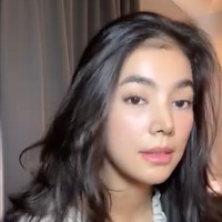 Dari unggahannya juga diketahui bahwa Raya menjalani beberapa prosedur operasi plastik, seperti rhinoplasty, endotine forehead, face contouring, dan buccal fat remover. Prosedur operasi plastiknya itu ditangani oleh 2 dokter, Dr. Oh Canghyun dan Dr. Yoo Kihyun. Foto: Instagram/@rayakohandi244