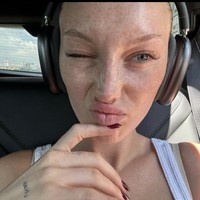 Meredith yang memiliki freckles juga tidak segan keluar rumah tanpa makeup. Pakai 10 pump foundation tidak semata-mata menutupi kekurangan wajahnya, namun bagian dari ekspresi kreatifnya.  Foto: dok. Instagram, TikTok