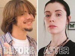 Potret Transgender Sebelum dan Setelah Operasi, Bikin Melotot Bedanya