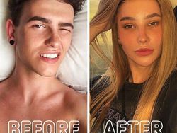 Potret Transgender Sebelum dan Setelah Operasi, Bikin Melotot Bedanya