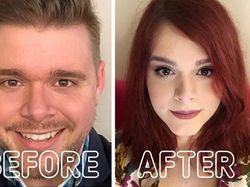 Potret Transgender Sebelum dan Setelah Operasi, Bikin Melotot Bedanya