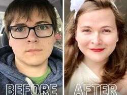 Potret Transgender Sebelum dan Setelah Operasi, Bikin Melotot Bedanya