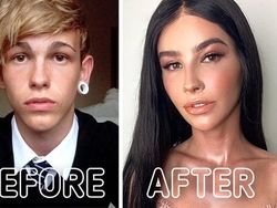 Potret Transgender Sebelum dan Setelah Operasi, Bikin Melotot Bedanya