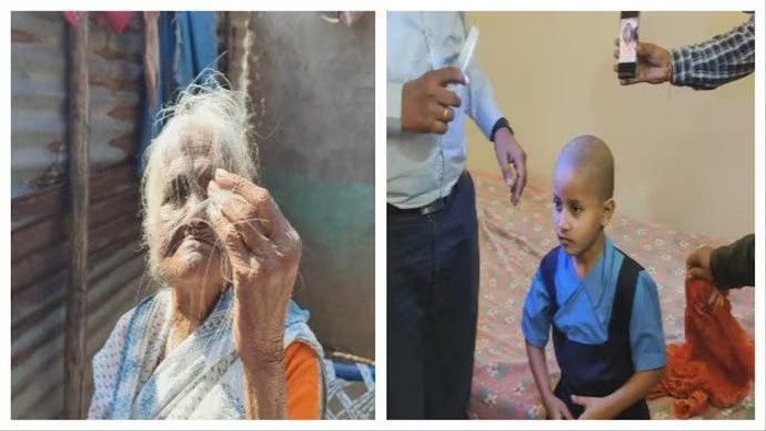 Epidemi Kebotakan di India