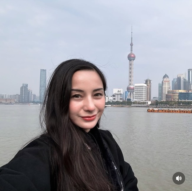 Dalam keterangan unggahannya Kirana juga mengungkapkan sebenarnya niat untuk menjalani rhinoplasty audah ada sejak lama, hanya saja kesempatannya baru datang saat ini. Untuk operasi tersebut Kirana ditangani oleh Dokter Korn dari Someko. Foto: Instagram/@kiranalarasati