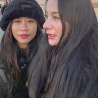 Dilihat dari samping, hidung Kirana kini jadi semakin mancung. Banyak netizen yang memuji Kirana, menyebut penampilannya kini jadi semakin cantik. Foto: Instagram/@kiranalarasati