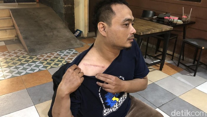 Korban kecelakaan menunjukan lukanya kepada wartawan di warung makannya, kawasan XT Square, Umbulharjo, Kota Jogja, Selasa (14/1/2025) malam.