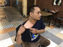 Korban Ungkap 2 Laka di Jogja Libatkan Darso Sebelum Tewas, Ini Sosok Sopirnya