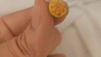 Netizen ini butuh waktu lama untuk bisa mengupas buah jeruk super mini hasil panennya yang gagal. Foto: Demilked/Site