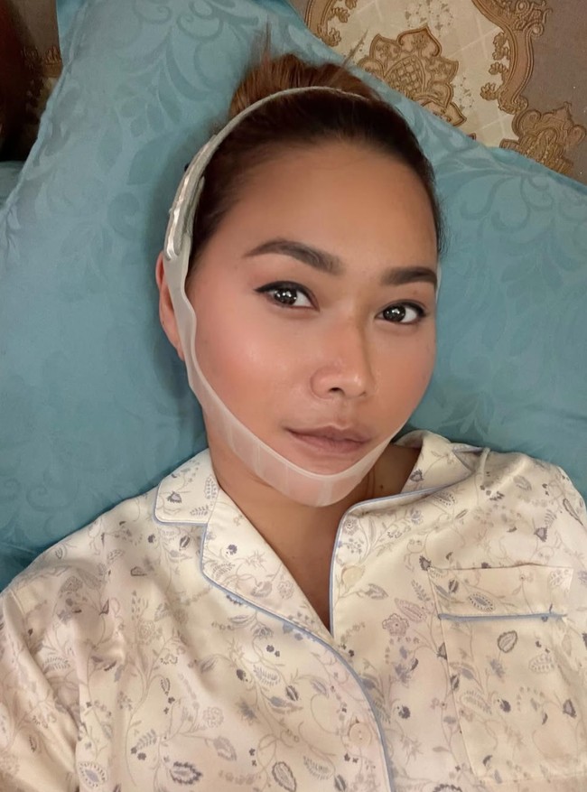 Untuk memaksimalkan perawatan wajahnya, istri Adam Suseno itu juga melakukan suntik untuk membuang lemak pada bagian pipinya agar tetap tirus. Inul sendiri hingga saat ini tampaknya masih memilih perawatan dibandingkan dengan oplas. Alasan utamanya ialah karena suaminya tak mengizinkan Inul untuk oplas. Foto: Instagram/@inul.d