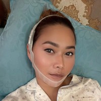 Untuk memaksimalkan perawatan wajahnya, istri Adam Suseno itu juga melakukan suntik untuk membuang lemak pada bagian pipinya agar tetap tirus. Inul sendiri hingga saat ini tampaknya masih memilih perawatan dibandingkan dengan oplas. Alasan utamanya ialah karena suaminya tak mengizinkan Inul untuk oplas. Foto: Instagram/@inul.d