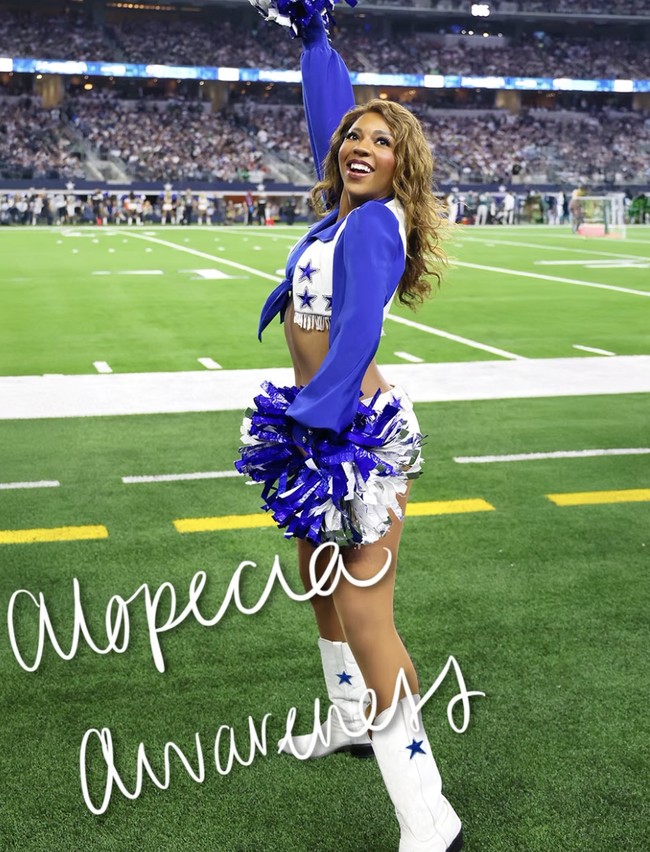 Tentu untuk sampai di tahap keberaniannya untuk tampil botak butuh waktu yang panjang. Namun Latimer akhirnya berani mengambil langkah baru tersebut.  Foto: dok. Instagram @ac_latimer