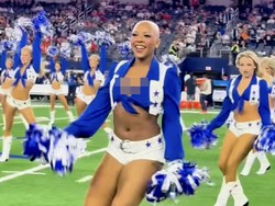 Foto Cheerleader yang Menginspirasi, Berani Tampil Botak Saat Menari di Publik