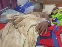 Pria di OKI Ditusuk Pisau yang Diduga Beracun, Saraf Rusak-Terancam Lumpuh