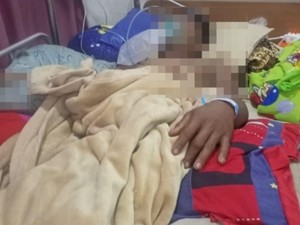 Tusukannya Rusak Saraf Pria OKI hingga Muncul Dugaan Pisau Pelaku Beracun