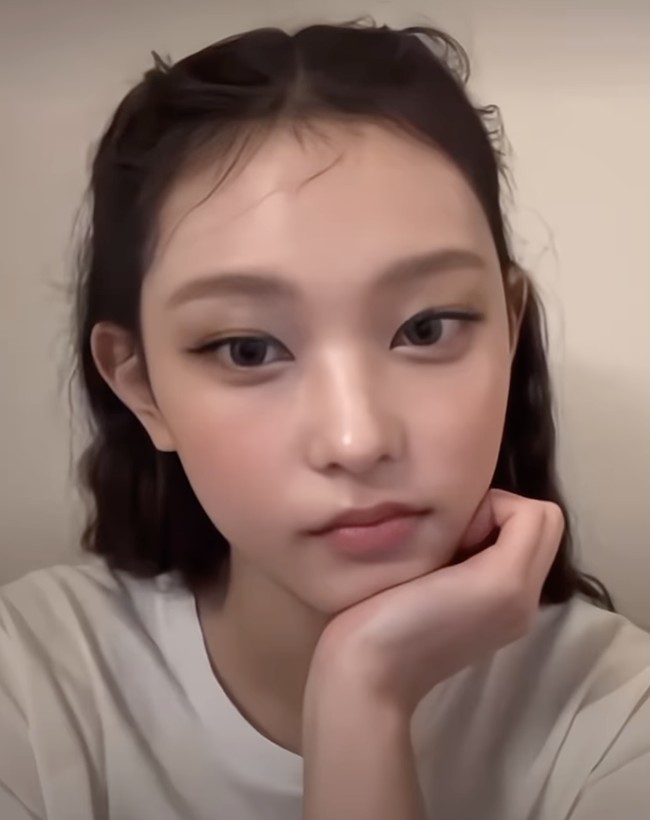 Karena itu, muncul tren suntik filler di bagian telinga. Hal ini mungkin terdengar aneh karena filler biasanya digunakan untuk di bagian bibir atau pipi.  Foto: dok. Instagram @newjeanshaerin