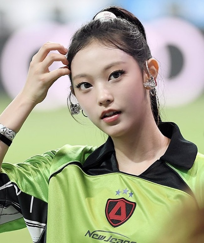 Meskipun tren ini semakin populer, pakar kesehatan memberikan peringatan. Dr. Deepak Dugar, seorang ahli bedah plastik yang berbasis di Beverly Hills, mengatakan bahwa prosedur ini berisiko tinggi dan tidak direkomendasikan. Foto: dok. Instagram @newjeanshaerin