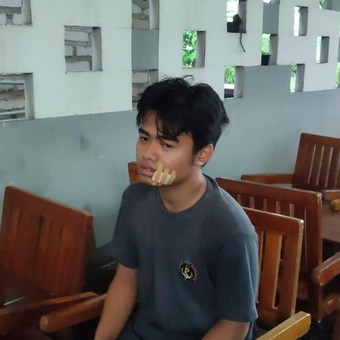 Korban terkena jebakan benang nilon di Jembatan Suramadu.