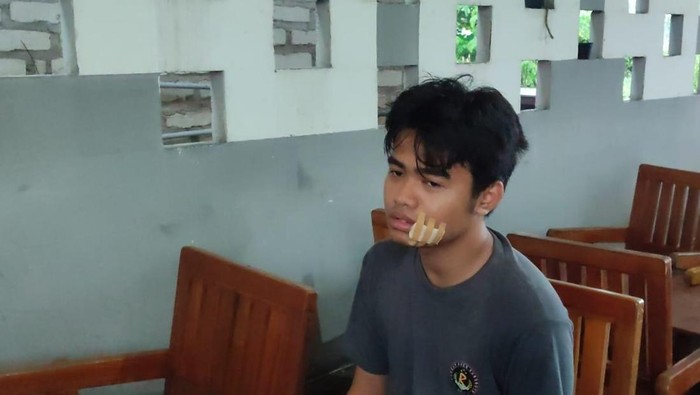 Korban terkena jebakan benang nilon di Jembatan Suramadu.