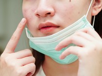 Mengenal Maskne, saat Jerawat Muncul karena Keseringan Pakai Masker