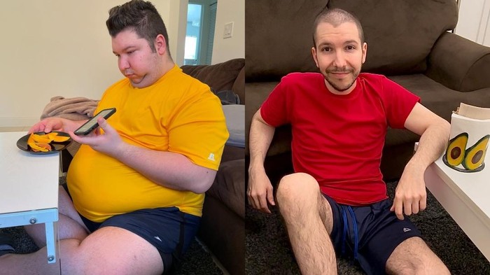 Tranformasi YouTuber Nikocado Avocado operasi rahang setelah berhasil menurunkan berat badan hingga 113 kg.