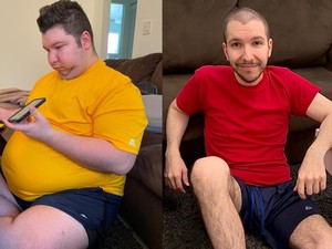 Youtuber Mukbang Nikocado Avocado Oplas Rahang usai Sukses Pangkas 113 Kg