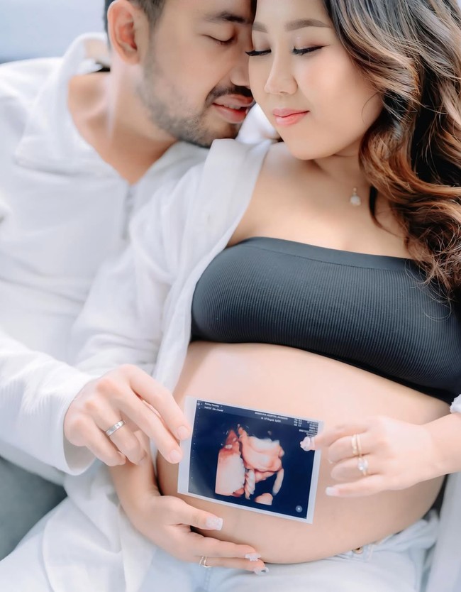 Kiky juga terlihat memamerkan foto USG 4D calon anak pertamanya itu. Baby K, you are the dream we’ve been waiting for, tulis keterangan dalam unggahannya. Foto: Instagram/@kikysaputrii