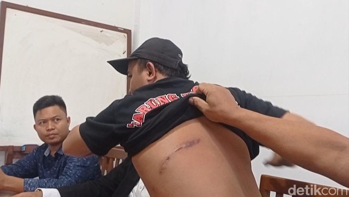 Korban kasus pengeroyokan di Tasikmalaya menunjukan lukanya.
