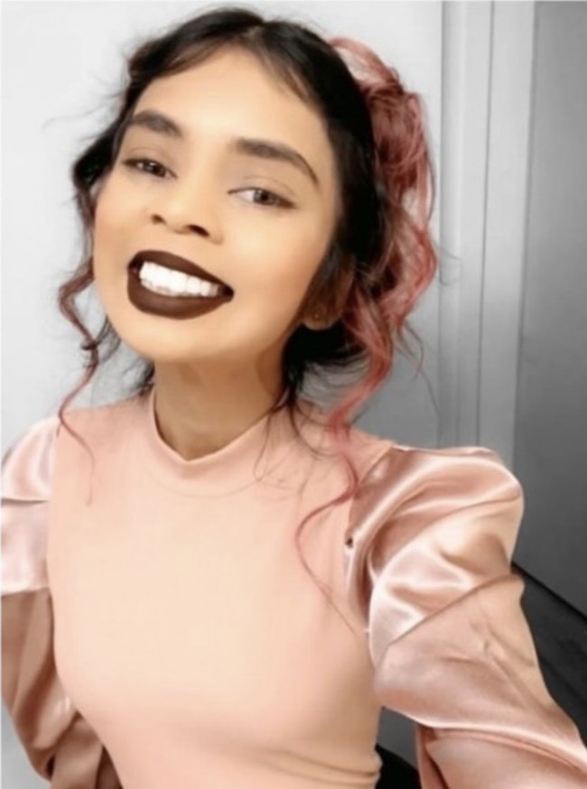 Pree didiagnosis menderita multiple sclerosis pada usia 19 tahun. Kondisinya itu memengaruhi sistem saraf pusatnya, menyebabkan berbagai gejala, termasuk inkontinensia—kondisi yang membuat seseorang sulit mengontrol kandung kemih.  Foto: dok. Instagram @bumblepree