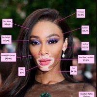 5. Winnie Harlow   Meski memiliki kondisi kulit vitiligo, kecantikan wajah Winnie Harlow tetap stand out. Selain menantang norma kecantikan, Winnie juga punya proporsi wajah hampir sempurna bahkan untuk bagian dahinya.   Foto: Dok. Blog Dr. Julian De Silva