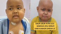 Awal Mula Devin Bocah di Bogor Idap Leukemia, Ayah Singgung Pola Makan UPF