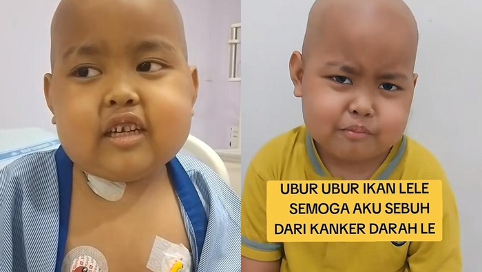 Viral Anak 6 Tahun Berjuang Lawan Kanker Darah, Harus 127 Kali Kemoterapi